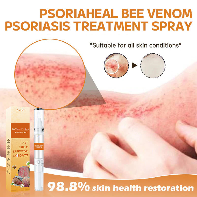 Awzlove™ Bee Venom Psoriasis Treatment Gel(Suitable for all skin conditions)🔥FREE for First 500 Customers🔥Just Today